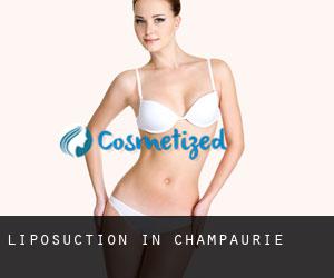 Liposuction in Champaurie