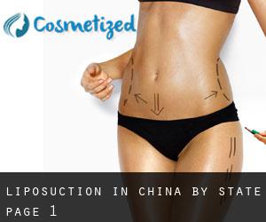 Liposuction in China by State - page 1