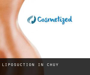 Liposuction in Chüy