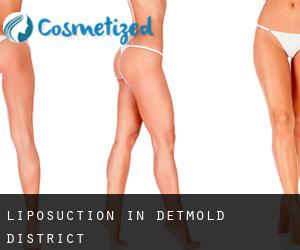 Liposuction in Detmold District