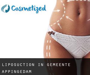 Liposuction in Gemeente Appingedam