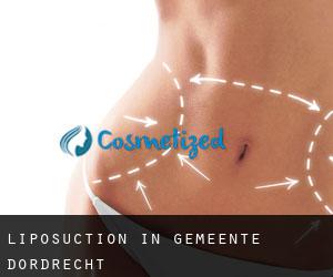 Liposuction in Gemeente Dordrecht