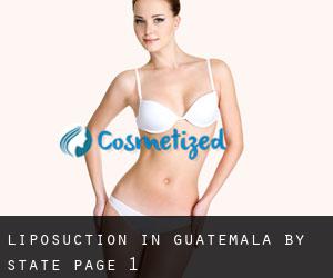 Liposuction in Guatemala by State - page 1