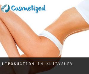 Liposuction in Kuibyshev