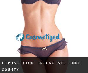 Liposuction in Lac Ste. Anne County
