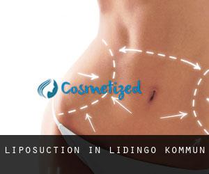Liposuction in Lidingö Kommun