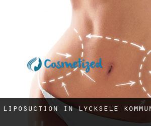 Liposuction in Lycksele Kommun