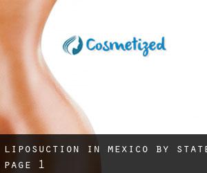 Liposuction in Mexico by State - page 1