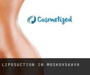 Liposuction in Moskovskaya