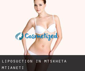 Liposuction in Mtskheta-Mtianeti