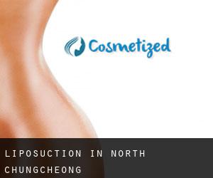 Liposuction in North Chungcheong