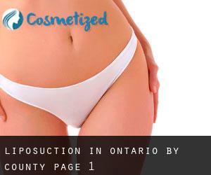 Liposuction in Ontario by County - page 1