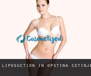 Liposuction in Opština Cetinje
