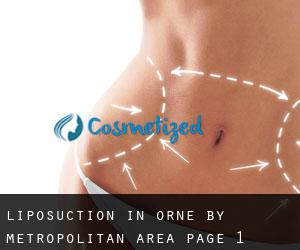 Liposuction in Orne by metropolitan area - page 1