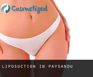 Liposuction in Paysandú