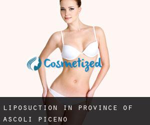 Liposuction in Province of Ascoli Piceno
