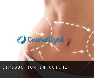 Liposuction in Quiché