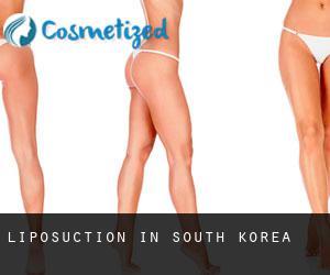 Liposuction in South Korea