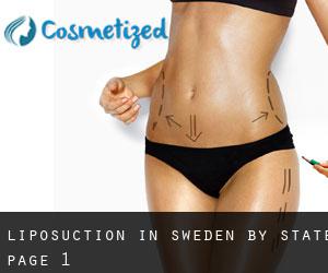 Liposuction in Sweden by State - page 1