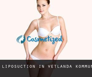 Liposuction in Vetlanda Kommun
