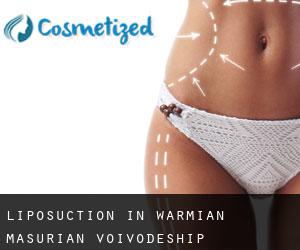 Liposuction in Warmian-Masurian Voivodeship