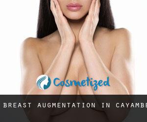 Breast Augmentation in Cayambe