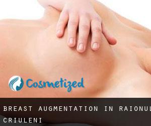 Breast Augmentation in Raionul Criuleni