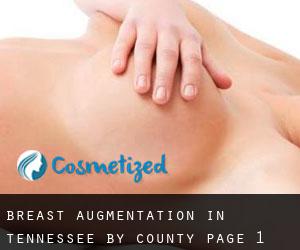 Breast Augmentation in Tennessee by County - page 1