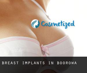 Breast Implants in Boorowa