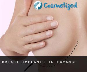 Breast Implants in Cayambe