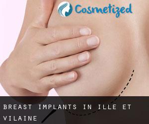 Breast Implants in Ille-et-Vilaine