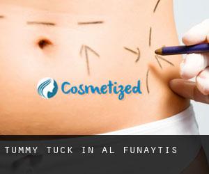 Tummy Tuck in Al Funayţīs