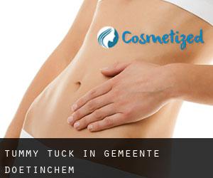 Tummy Tuck in Gemeente Doetinchem