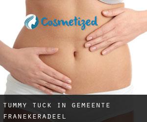 Tummy Tuck in Gemeente Franekeradeel