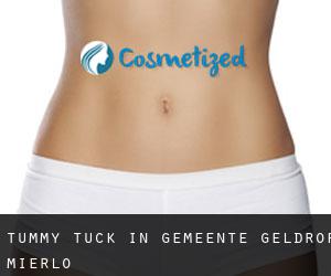 Tummy Tuck in Gemeente Geldrop-Mierlo