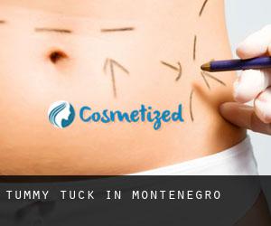 Tummy Tuck in Montenegro
