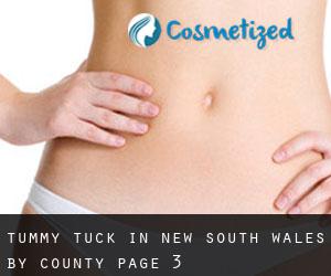 Tummy Tuck in New South Wales by County - page 3