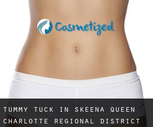 Tummy Tuck in Skeena-Queen Charlotte Regional District
