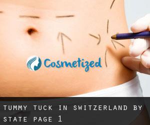Tummy Tuck in Switzerland by State - page 1