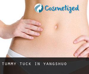 Tummy Tuck in Yangshuo