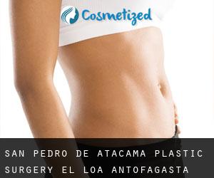 San Pedro de Atacama plastic surgery (El Loa, Antofagasta)