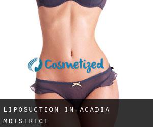 Liposuction in Acadia M.District
