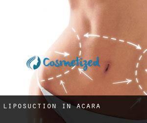 Liposuction in Acará