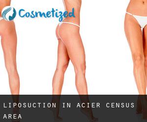 Liposuction in Acier (census area)