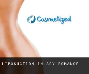 Liposuction in Acy-Romance
