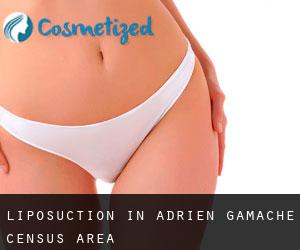 Liposuction in Adrien-Gamache (census area)