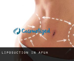 Liposuction in Afuá