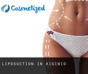Liposuction in Aigínio