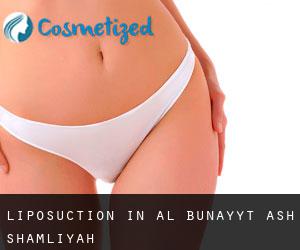 Liposuction in Al Bunayyāt ash Shamālīyah