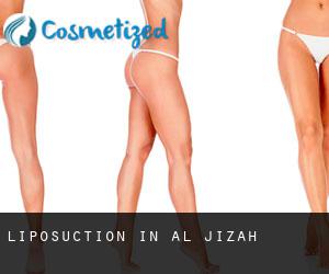 Liposuction in Al Jīzah
